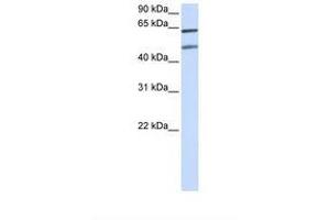 Image no. 1 for anti-Optineurin (OPTN) (AA 72-121) antibody (ABIN6737673)