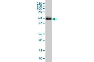PBX2 monoclonal antibody (M01), clone 2E9 Western Blot analysis of PBX2 expression in Hela S3 NE . (PBX2 抗体  (AA 354-430))