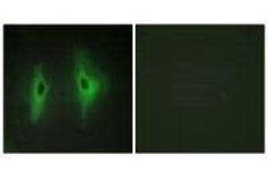 Immunofluorescence analysis of HeLa cells, using DGKH antibody. (DGKH 抗体)