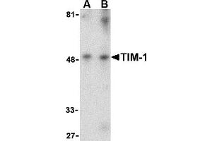 Western Blotting (WB) image for anti-Hepatitis A Virus Cellular Receptor 1 (HAVCR1) (Middle Region) antibody (ABIN1031124) (HAVCR1 抗体  (Middle Region))