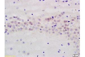 Formalin-fixed and paraffin embedded rat brain labeled with Anti-AMPK beta 1 Polyclonal Antibody, Unconjugated  at 1:200 followed by conjugation to the secondary antibody and DAB staining. (PRKAB1 抗体  (AA 201-270))