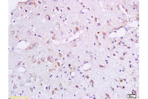 Formalin-fixed and paraffin embedded rat brain labeled with Anti-BCAT1 Polyclonal Antibody, Unconjugated (ABIN718856) at 1:200 followed by conjugation to the secondary antibody and DAB staining. (BCAT1 抗体  (AA 321-386))