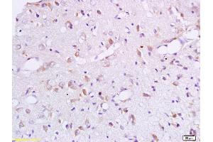 Formalin-fixed and paraffin embedded rat brain labeled with Anti-BCAT1 Polyclonal Antibody, Unconjugated (ABIN718856) at 1:200 followed by conjugation to the secondary antibody and DAB staining.