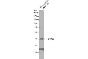 WB Image GPR120 antibody detects GPR120 protein by western blot analysis. (O3FAR1 抗体  (N-Term))
