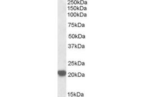 Western Blotting (WB) image for anti-Ras-Related C3 Botulinum Toxin Substrate 2 (Rho Family, Small GTP Binding Protein Rac2) (RAC2) (C-Term) antibody (ABIN2465289) (RAC2 抗体  (C-Term))