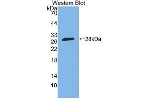 Detection of Recombinant SP140, Human using Polyclonal Antibody to Sp140 Nuclear Body Protein (SP140) (SP140 抗体  (AA 443-655))