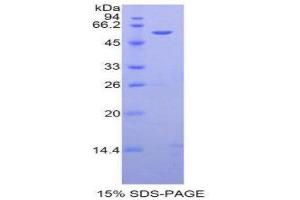 SDS-PAGE (SDS) image for alpha-2-HS-Glycoprotein (AHSG) (AA 19-300) protein (His tag,GST tag) (ABIN2122381)