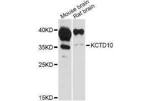 Western blot analysis of extracts of various cell lines, using KCTD10 Antibody (ABIN5998054) at 1:3000 dilution. (KCTD10 抗体)