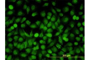 Immunofluorescence of monoclonal antibody to MAPK9 on HeLa cell. (JNK2 抗体  (AA 321-424))