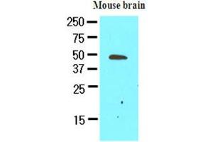 The extracts of mouse brain (50ug) were resolved by SDS-PAGE, transferred to NC membrane and probed with anti-human GAS7 (1:500). (GAS7 抗体)