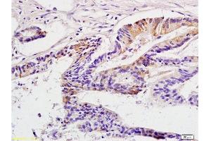 Immunohistochemistry (Paraffin-embedded Sections) (IHC (p)) image for anti-Cancer/testis Antigen 2 (CTAG2) (AA 121-210) antibody (ABIN721135) (CTAG2 抗体  (AA 121-210))