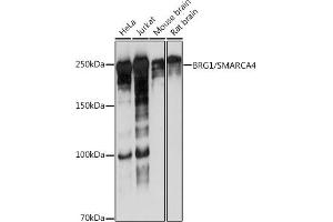 Western blot analysis of extracts of various cell lines, using BRG1/SM antibody (ABIN7270655) at 1:1000 dilution. (SMARCA4 抗体)
