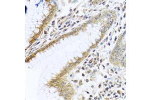 Immunohistochemistry of paraffin-embedded human stomach using TMEM189 antibody at dilution of 1:100 (40x lens). (TMEM189 抗体)