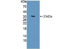 Detection of Recombinant PLCb2, Human using Polyclonal Antibody to Phospholipase C Beta 2 (PLCb2) (Phospholipase C beta 2 抗体  (AA 1-250))