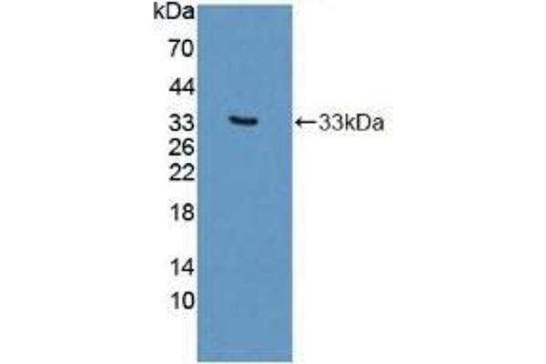 Phospholipase C beta 2 抗体  (AA 1-250)