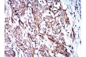 Immunohistochemistry (IHC) image for anti-BCL2/adenovirus E1B 19kDa Interacting Protein 3 (BNIP3) (AA 50-155) antibody (ABIN5542288)