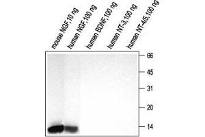 Western blot analysis using Anti-NGF Antibody (ABIN7044627) (1:200). (Nerve Growth Factor 抗体  (Intracellular))