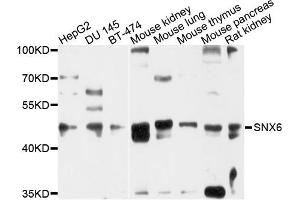 Western blot analysis of extracts of various cells, using SNX6 antibody. (SNX6 抗体)