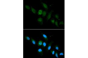 Immunofluorescence (IF) image for anti-Major Histocompatibility Complex, Class I, A (HLA-A) antibody (ABIN1873024)