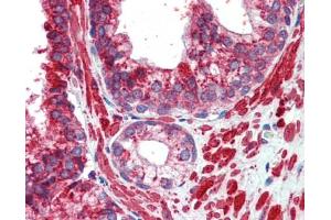 Immunohistochemistry (IHC) image for anti-Transcription Factor AP-2 gamma (Activating Enhancer Binding Protein 2 Gamma) (TFAP2C) (Middle Region) antibody (ABIN2777941)