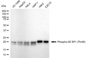 Western blotting analysis using phospho-4E BP1 (Thr46) antibody (ABIN7798530). (Recombinant eIF4EBP1 抗体  (pThr46))