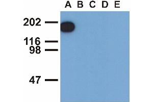 Western blotting analysis of EGFR (phospho-Tyr1173) by mouse monoclonal antibody EM-13 inEGF-treated A431 (A), CALU-3 (B), MCF-7 (C), Jurkat (D) and Ramos (E) cell lines (reduced conditions). (EGFR 抗体  (Tyr1173))