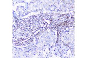 IHC analysis of INPPL1 using anti-INPPL1 antibody (ABIN6719492). (INPPL1 抗体  (AA 1172-1258))