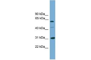 WB Suggested Anti-RAD1 Antibody Titration: 0. (RAD1 抗体  (Middle Region))