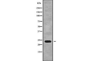 Western blot analysis of RAB15 using RAW264. (RAB15 抗体  (Internal Region))