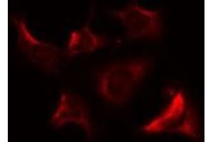 ABIN6274723 staining A549 by IF/ICC. (MRPS9 抗体  (Internal Region))