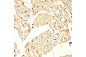 Immunohistochemistry of paraffin-embedded mouse heart using HIF1AN antibody (ABIN5973179) at dilution of 1/100 (40x lens). (HIF1AN 抗体)