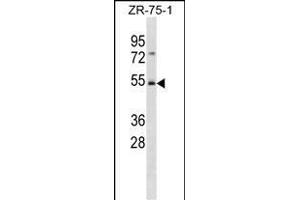 FBXW4 Antibody (C-term) (ABIN1881340 and ABIN2839057) western blot analysis in ZR-75-1 cell line lysates (35 μg/lane). (FBXW4 抗体  (C-Term))