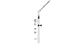 Anti-Myc Tag Antibody at 1:2000 dilution + 12 tag recombinant protein lysate Lysates/proteins at 20 μg per lane.