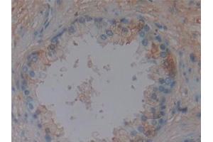 Detection of DBP in Human Prostate Tissue using Polyclonal Antibody to Vitamin D Binding Protein (DBP) (Vitamin D-Binding Protein 抗体  (AA 395-474))