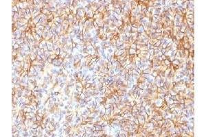 IHC testing of FFPE human pancreas with Spectrin beta III antibody (clone SPTBN2/1584). (Spectrin, Beta, Non-erythrocytic 2 (SPTBN2) (AA 356-475) 抗体)