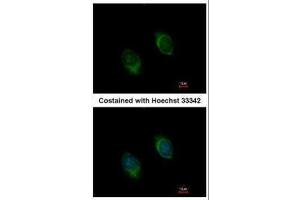 ICC/IF Image Immunofluorescence analysis of methanol-fixed HeLa, using BMP4, antibody at 1:100 dilution. (BMP4 抗体)