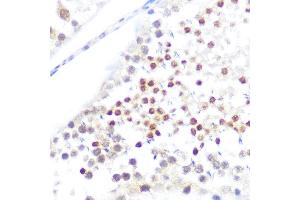 Immunohistochemistry of paraffin-embedded rat testis using NUP50 Rabbit pAb (ABIN6128364, ABIN6144963, ABIN6144964 and ABIN6225005) at dilution of 1:100 (40x lens). (NUP50 抗体  (AA 299-468))