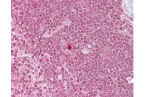 Anti-ZBTB7A antibody IHC of human thymus. (ZBTB7A 抗体  (N-Term))