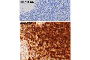 Immunohistochemistry (IHC) image for anti-CD5 (CD5) (AA 105-210) antibody (ABIN7272988) (CD5 抗体  (AA 105-210))