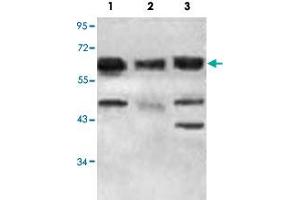 Western blot analysis of 293T (Lane 1), K-562 cells (Lane 2) and fetal heart tissue lysate with ACAD9 polyclonal antibody  at 1 : 500 dilution.