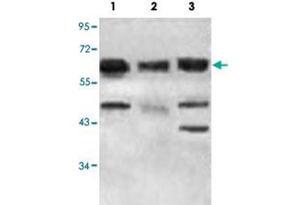 ACAD9 antibody  (AA 1464-1642)