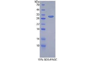 SDS-PAGE analysis of Rat GIF Protein. (Intrinsic Factor 蛋白)