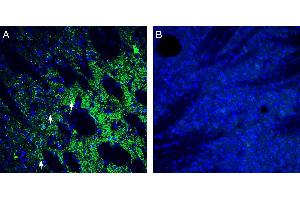 Expression of ZIP14 in mouse striatum. (Solute Carrier Family 39 (Zinc Transporter), Member 14 (SLC39A14) Peptide)