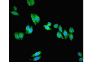 Immunofluorescent analysis of HepG2 cells using ABIN7162599 at dilution of 1:100 and Alexa Fluor 488-congugated AffiniPure Goat Anti-Rabbit IgG(H+L) (PANK1 抗体  (AA 462-582))