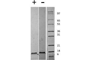 SDS-PAGE of Mouse Stromal Cell-Derived Factor-1 beta (CXCL12) Recombinant Protein SDS-PAGE of Mouse Stromal Cell-Derived Factor-1 beta (CXCL12) Recombinant Protein. (SDF1 beta 蛋白)