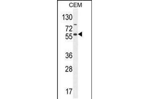 Western blot analysis in CEM cell line lysates (35ug/lane). (NFKBIL1 抗体  (AA 256-285))