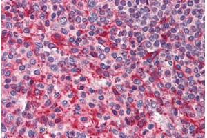 Human Spleen (formalin-fixed, paraffin-embedded) stained with PAK4 antibody ABIN214461 at 2. (PAK4 抗体  (Internal Region))