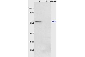 Lane 1: mouse lung lysates Lane 2: mouse stomach lysates probed with Anti Phospho-PPAR Gamma (ser273) Polyclonal Antibody, Unconjugated (ABIN734663) at 1:200 in 4 °C. (PPARG 抗体  (pSer273))