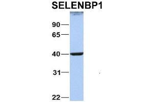 Host:  Rabbit  Target Name:  NOP56  Sample Type:  MCF7  Antibody Dilution:  1. (SELENBP1 抗体  (C-Term))