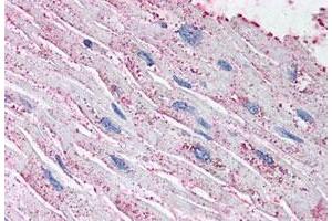 Immunohistochemistry (Formalin/PFA-fixed paraffin-embedded sections) of human heart tissue with EDNRA polyclonal antibody . (Endothelin-1 Receptor 抗体  (N-Term))
